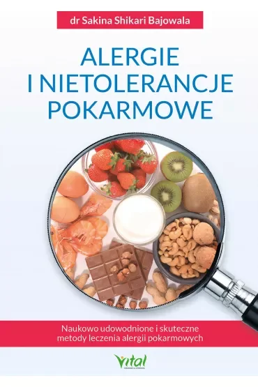 Alergie i nietolerancje pokarmowe. Naukowo udowodnione i skuteczne metody leczenia alergii pokarmowych