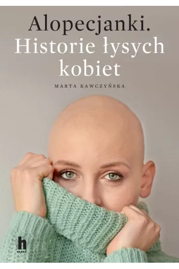 Alopecjanki. Historie łysych kobiet