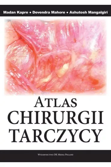 Atlas chirurgii tarczycy