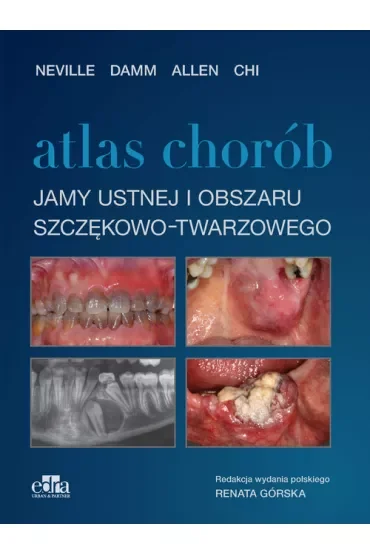 Atlas chorób jamy ustnej i obszaru szczękowo-twarzowego