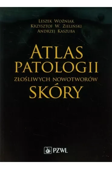 Atlas patologii złośliwych nowotworów skóry