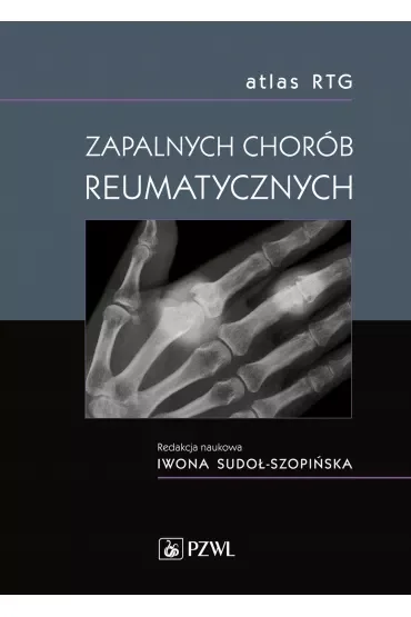 Atlas RTG zapalnych chorób reumatycznych