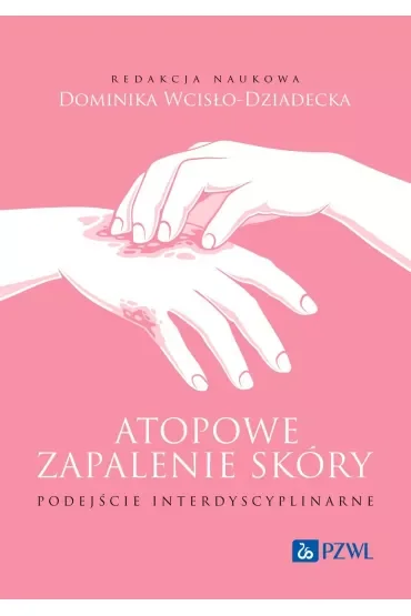 Atopowe zapalenie skóry. Podejście interdyscyplinarne