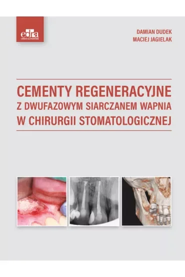 Cementy regeneracyjne z dwufazowym siarczanem wapnia w chirurgii stomatologicznej