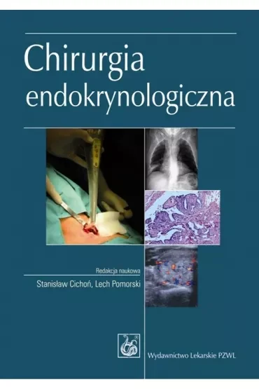 Chirurgia endokrynologiczna