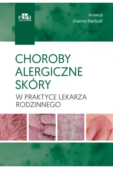 Choroby alergiczne skóry w praktyce lekarza rodzinnego