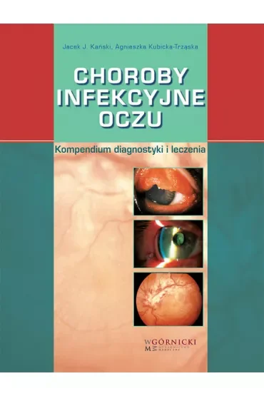 Choroby infekcyjne oczu. Kompendium diagnostyki i leczenia