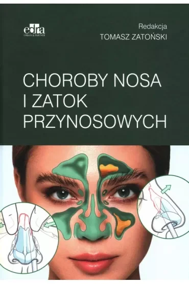 Choroby nosa i zatok przynosowych