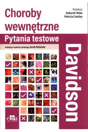 Choroby wewnętrzne. Davidson. Pytania testowe