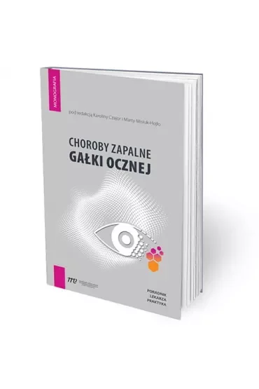 Choroby zapalne gałki ocznej - poradnik lekarza pr