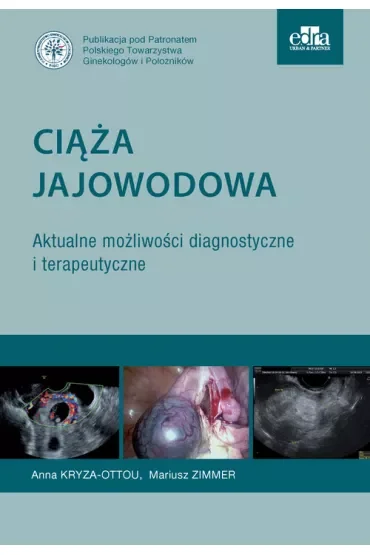 Ciąża jajowodowa. Aktualne możliwości diagnostyczne i terapeutyczne
