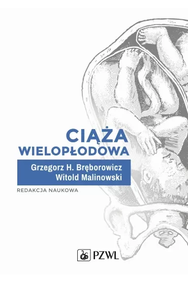 Ciąża wielopłodowa