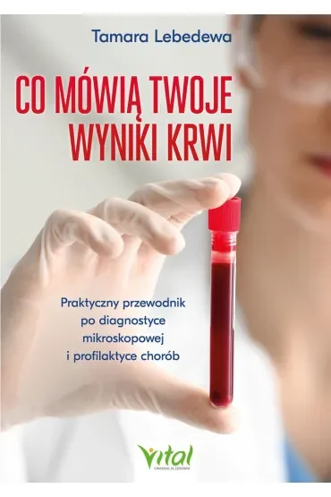 Co mówią twoje wyniki krwi. Praktyczny przewodnik po diagnostyce mikroskopowej i profilaktyce chorób