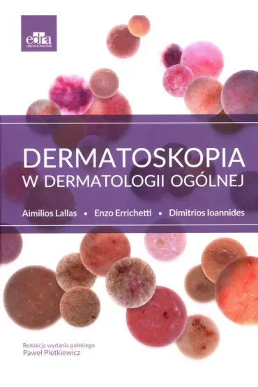Dermatoskopia w dermatologii ogólnej