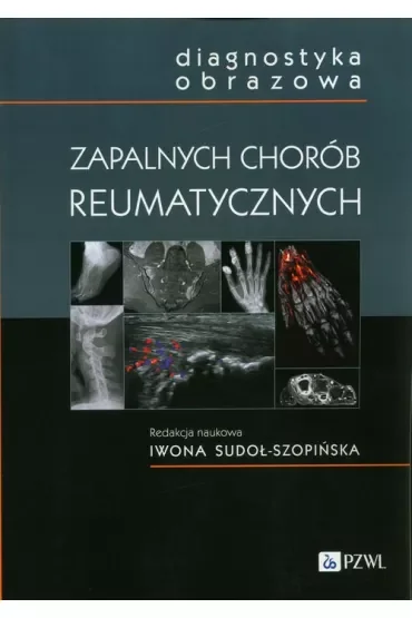 Diagnostyka obrazowa zapalnych chorób reumatycznych