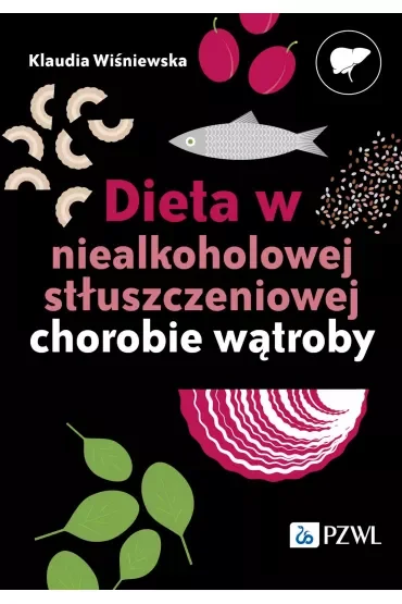 Dieta w niealkoholowej stłuszczeniowej chorobie wątroby