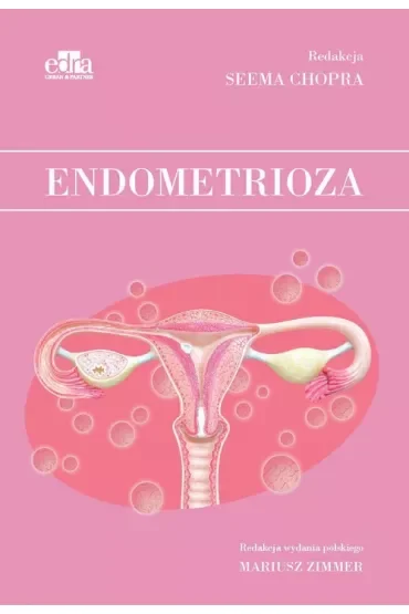 Endometrioza
