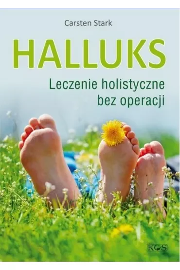 Halluks. Leczenie holistyczne bez operacji