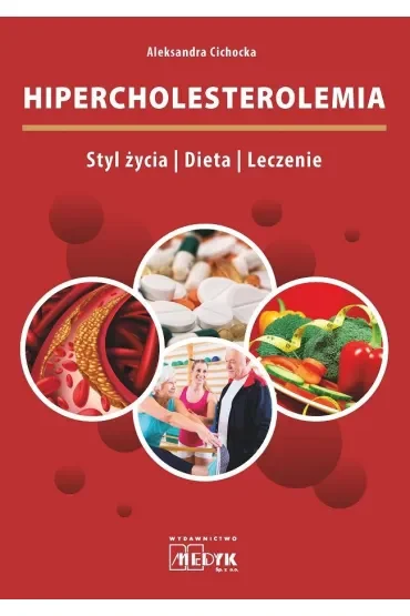 Hipercholesterolemia Styl życia Dieta Leczenie