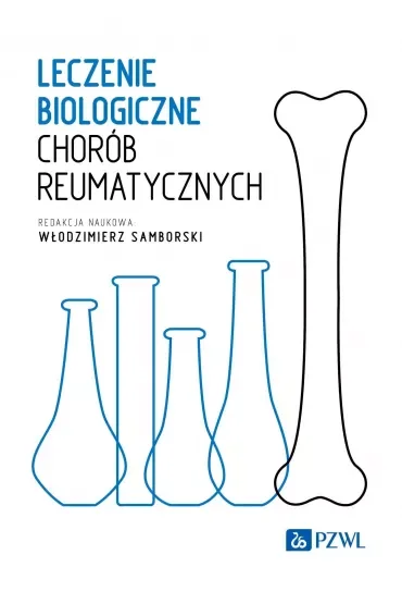 Leczenie biologiczne chorób reumatycznych