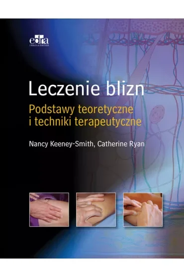 Leczenie blizn pourazowych