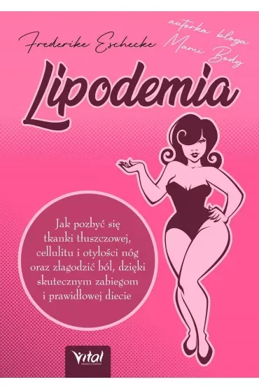 Lipodemia. Jak pozbyć się tkanki tłuszczowej, cellulitu i otyłości nóg oraz złagodzić ból, dzięki skutecznym zabiegom i prawidłowej diecie