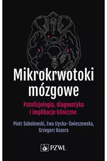 Mikrokrwotoki mózgowe
