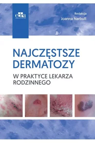 Najczęstsze dermatozy w praktyce lekarza rodzinn.