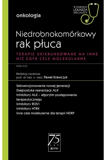 Niedrobnokomórkowy rak płuca. Terapie ukierunkowane na inne niż EGFR cele molekularne. Onkologia. W gabinecie lekarza specjalisty
