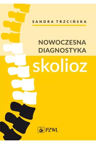 Nowoczesna diagnostyka skolioz