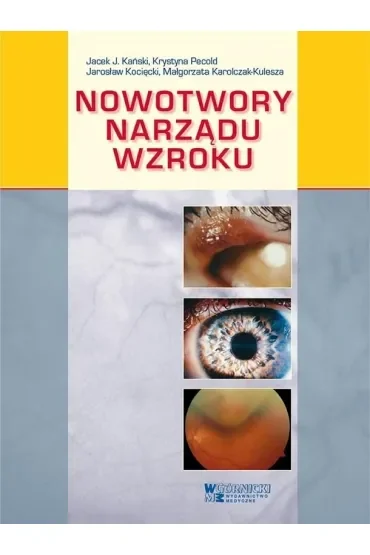 Nowotwory narządu wzroku