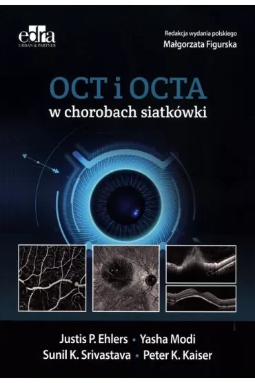 Oct i octa w chorobach siatkówki