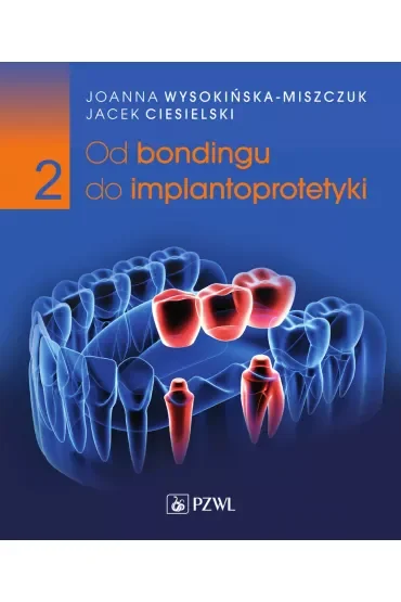 Od bondingu do implantoprotetyki. Część 2