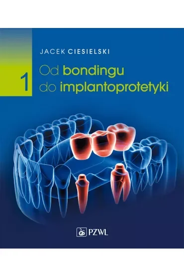 Od bondingu do implantoprotetyki. Tom 1