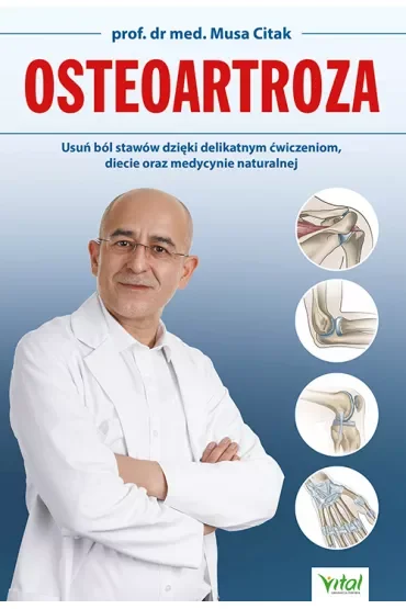 Osteoartroza