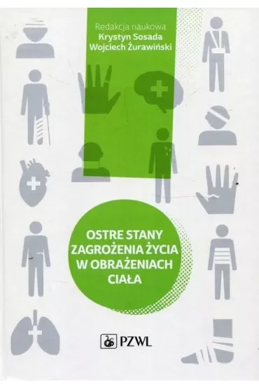 Ostre stany zagrożenia życia w obrażeniach ciała