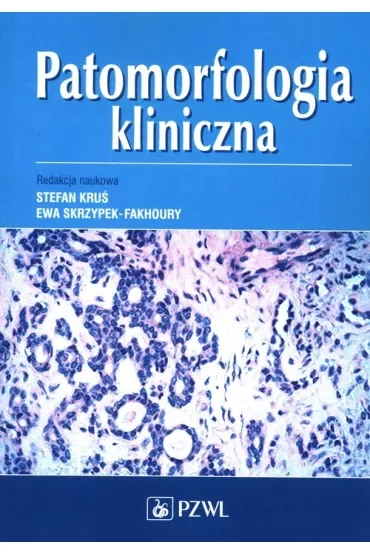 Patomorfologia kliniczna