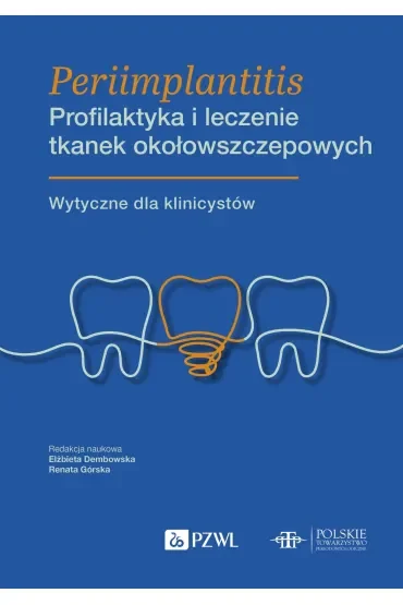 Periimplantitis. Profilaktyka i leczenie tkanek okołowszczepowych