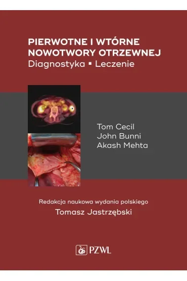 Pierwotne i wtórne nowotwory otrzewnej