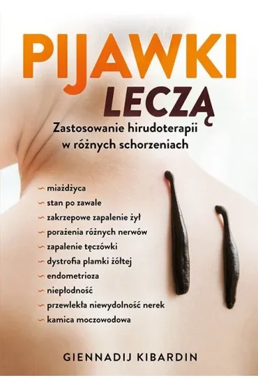 Pijawki leczą