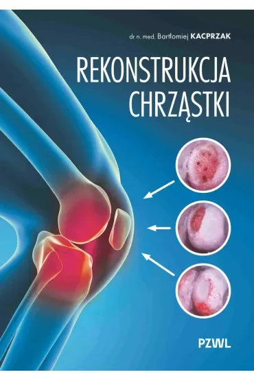 Rekonstrukcja chrząstki. Ratujemy kolano, nie wymieniamy