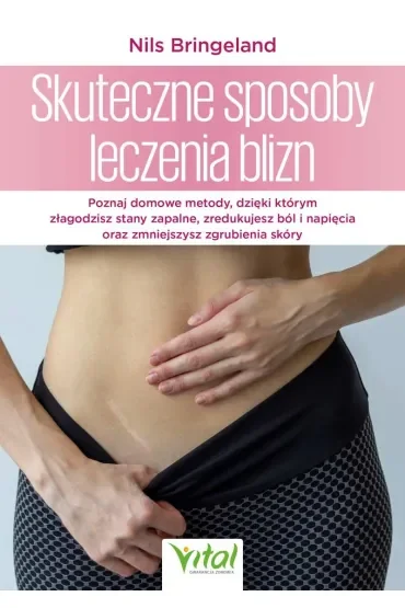 Skuteczne sposoby leczenia blizn
