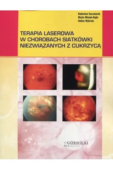 Terapia laserowa w chorobach siatkówki niezwiązanych z cukrzycą