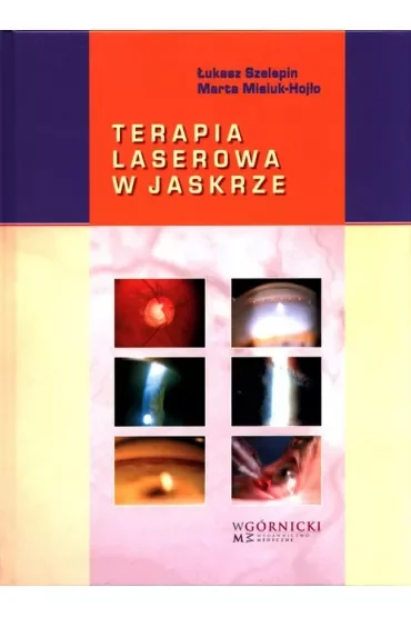 Terapia laserowa w jaskrze