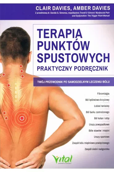 Terapia punktów spustowych – praktyczny podręcznik
