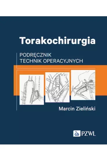 Torakochirurgia