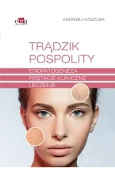 Trądzik pospolity. Etiopatogeneza, postacie kliniczne, leczenie