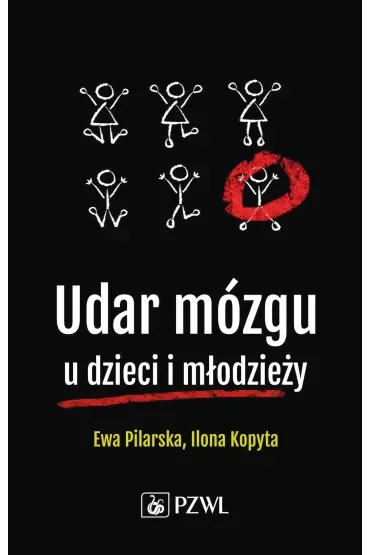 Udar mózgu u dzieci i młodzieży