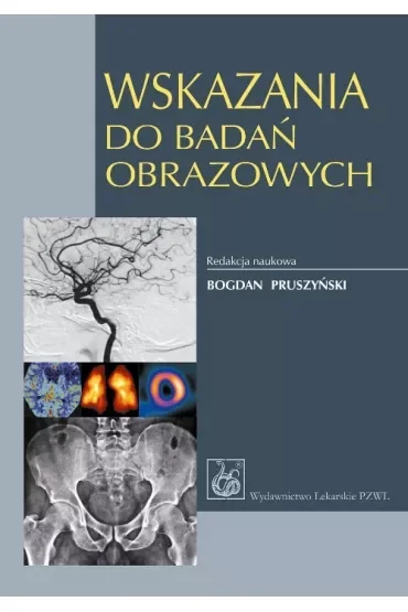 Wskazania do badań obrazowych
