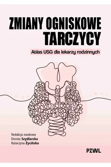 Zmiany ogniskowe tarczycy. Atlas USG dla lekarzy rodzinnych